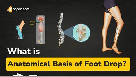 the foot drop test|anatomical basis of foot drop.